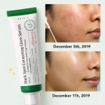 خرید سرم ضد لک و ضد جوش Axis-Y Dark Spot Correcting Serum